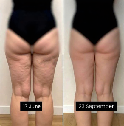 3D Leggings with Resistance Band | Metabolism Booster